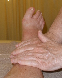 Manual Lymphatic Drainage Therapy